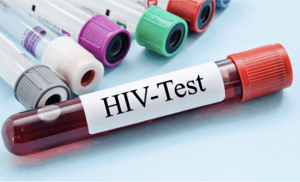 Ghana AIDS Commission Raises Alarm Over HIV Infections In Bono Region