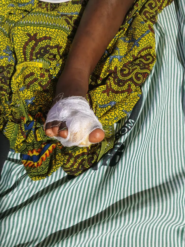 Mother arrested for allegedly severing daughter's toe in Juaboso