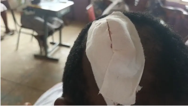 Two BECE candidates sit for exams despite motor accident in Nkwanta South