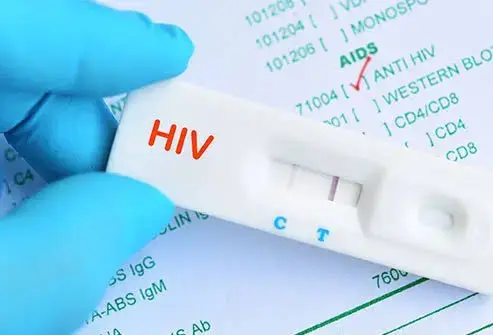 Ghana risks potential shortage of HIV testing kits by end of July