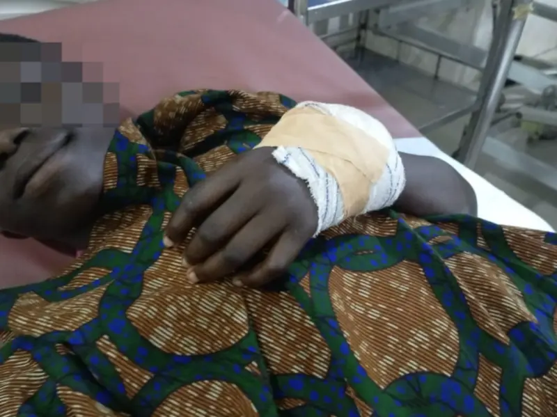 Student injured in cutlass attack over alleged sexual harassment at Assin Krofofrodo