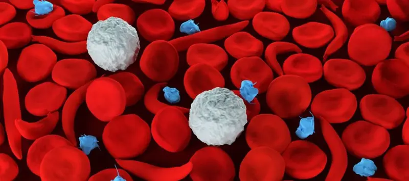 14 days in ICU: Sickle cell is more than a disease we remember in September