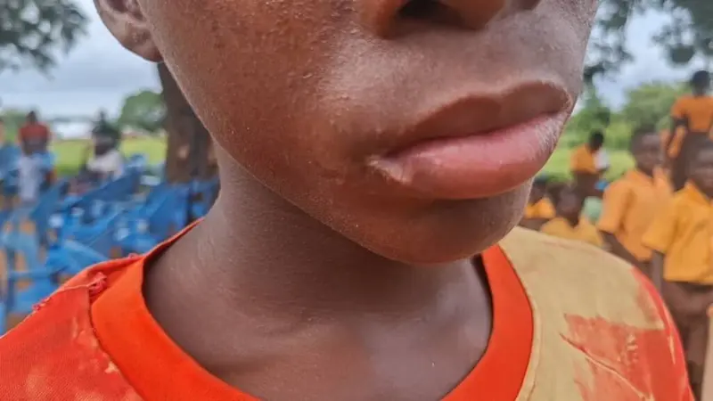 Mysterious illness leaves children struggling to walk, hear as Mafi Kope community appeals for urgent medical help 