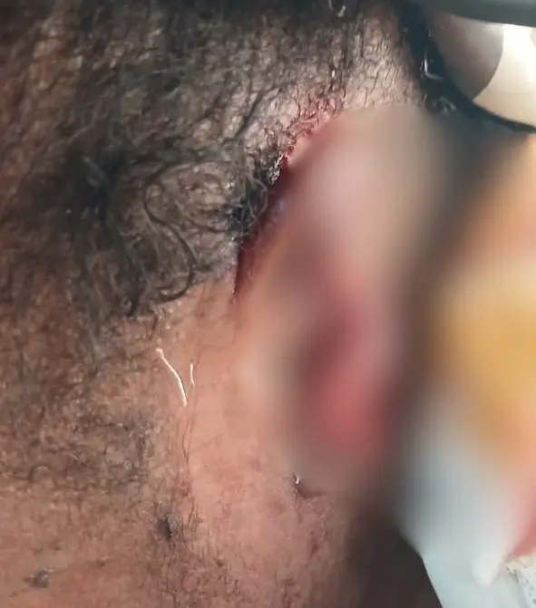 Police arrest landlord's wife for allegedly biting tenant's ear during a fight